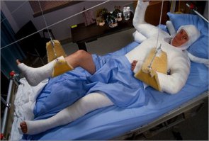 Представляю как весело будет по пьяни с этого дерева десантироваться.Память останется на долго))