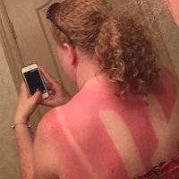 Гражданка решила загаром сделать на всю спину логотип танковой дивизии Das Reich и/или карательного батальона "Азов"?