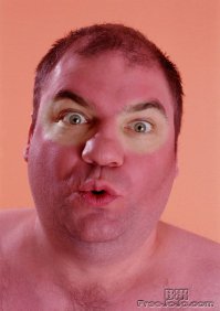 20 людей, которые обречены провести лето с нелепым загаром