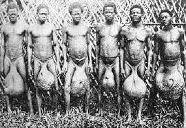 а вот и яйца .. с древних времен об этом некоторые мечтали .. вообще увеличение отдельных выступающих "органов" было модно во многих культурах увеличение шеи, головы, губ, ушей ... ну и яиц тож