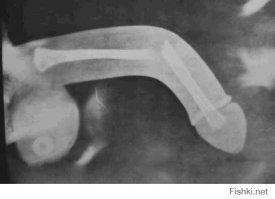 Напоследок можно было и бонус подложить ))