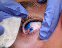 Думаю...тату я не хочу...вообще никакое!