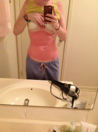 Я не понял, у нее лифак съехал когда она загорала, или где у нее сиськи?