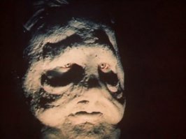 Простите ,но все фото узи -напоминают Весельчака...