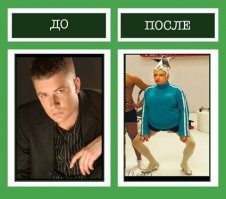 10 знаменитостей до и после пластической хирургии