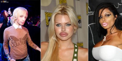 10 знаменитостей до и после пластической хирургии