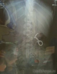 Взрослые !!! Не покупайте эту фигню ! 
Для маленьких Детей Смертельно ОПАСНО !
Если у Вас есть Дети, Племянники, Друзья с детьми - НЕ покупать ВООБЩЕ !!! Перитонит - это минимум. Хирурги будут резать, а Вы локти кусать и успокаивать рыдающих Женщин !
Автору ЖИРНЫЙ минус за такую рекламу без указания возраста +18 !