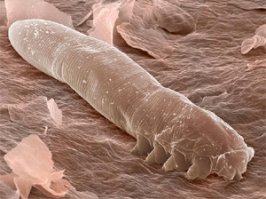 >А что за хрень на ресницах сидит???
Вши лобковые.
>Демодекс
Нет, вши. 
Демодекс вот так выглядит: