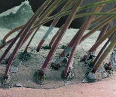 Вот ресница под микроскопом, а то, что на первом фото называется Демодекоз ресниц. И если ты автор сделал фото своих ресниц, то у тебя проблемы.