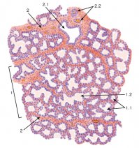 Не, тут не совсем корректно подобраны картинки, здесь где то под микроскопом простым, где то под электронным (смоделированное изображение, так как электронный микроскоп в цвете не показывает, он показывает только формы объектов, а о размере судят в зависимости от используемых частиц для просмотра), конечно все это выглядит эффекто, но не информативно.
В общем предлагаю для общего развития посмотреть кое что из представленного под простым микроскопом, так, как это делают гистологи или патологоанатомы. И да, на реснице - паразит, если, это вообще ресница ;). на волосе никакой не демодикоз, как некоторые предполагают. это обычная вошь, скорее всего лобкова
Собственно примеры микропрепаратов:
4 - лобковая вошь на волосе

1. Ресница

2. Листовидные сосочки языка

В общем эти картинки выглядят не так эффектно, зато гораздо более информативны, в плане понимания структуры и функции органов в нашем организме. А вот к примеру рак молочной железы (3): Сразу видны недифференцированные клетки, они нарушают структуру органа, мешают его функции, сравните с последней картинкой (5) - микропрепарат нормальной молочной железы, где отчетливо видны протоки, жировая ткань, соединительнотканная строма... Ну и хотел сказать пару слов о том, как делают микропрепараты, вкратце: Берут участок органа, который надо смотреть, отрезают или отщепляют от туда кусочек ткани, от этого кусочка делают тончайший срез, этот срез красят специальным веществом, благодаря которому отчетливо видны ядра клеток и сами клетки, и в зависимости от того, что смотрят своя окраска, а потом внимательно смотрят, и описывают то, что видят.  

Извиняюсь за картинки не по порядку, смотрите цифру в тексте, просто нашел более показательные, а выстраивать все по порядку уже нет времени да и желания ;)