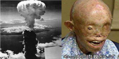 Уцелел при ядерной бомбардировке Нагасаки .