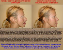 Да уж...
Даже лошадь Псюша Собачак на этом фоне почти ничего... (((