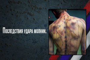 татуировка, знатная получилась, бы...