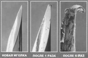 Помню как меня Мать покойная колола многоразовыми иголками к такому же многоразовому шприцу. Кто помнит тот поймет о чем речь (железный стирилизатор, стеклянный шприц...) Втыкает мне в ягодицу, я ору, она - чего орешь как маленький? (лет 15 было тогда). Я и сам не пойму от чего так больно. Затем вынимает иголку - я ору. Да всё, уже вытащила, хорош орать. Я смотрю на шприц, а там на кончике иглы мяско... ппц. Игла как самая крайняя - крючком.