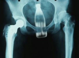 А уж у людей то что находят не в том месте...