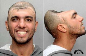 Человек без мозга живет и удивляет ученых.               Мозг – пожалуй, самый важный орган человека. Он управляет нашим телом, он отвечает за наше сознание и эмоции. Мозг – это, собственно, и есть человек. И так долгое время считали все ученые мира, пока в правиле не появилось исключение, заставившее ученых пересмотреть этот постулат.
Жизнерадостный американец по имени Карлос Родригес живет практически без мозга. У него нет лобных долей, да и вообще мало что есть в черепной коробке после страшной автокатастрофы. Но он ничем не отличается от других людей… когда носит шапку.                   Существует также описанный случай 16-го века, когда анатомировали мальчика, скончавшегося спустя 3 года после тяжелой травмы черепа. При вскрытии у него не нашли мозга. Как он жил эти три года? Ряд ученых полагает, что существует так называемый «брюшной мозг». И действительно, в желудке и кишечнике около 100 миллионов нервных клеток, куда больше, чем в спинном мозге, например. Что до Родригеса, то личность его совершенно не изменилась после того, как у него удалили больше 60% головного мозга, не изменилась память и когнитивные способности. Чем же он думает? Ответить на этот вопрос ученым еще предстоит.