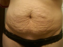 Вот что такое дряблость/ Не хотел искать ну вынудили