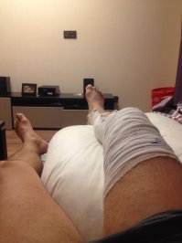 Страх господний) жестко , тяжелое востоновление , сам дома лежу 3 недели в лангете менискам хана и берцовой кости))
Но есть плюс на любимых фишках онлайн ))