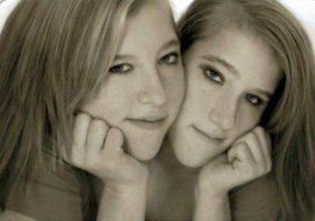 сиамские близнецы КСЕНИИ СОБЧАК