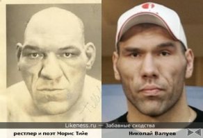 Топ 5 людей с редчайшими аномалиями