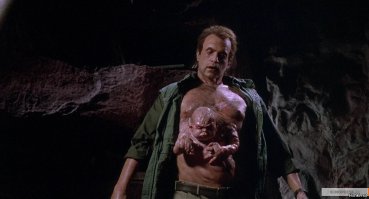 Топ 5 людей с редчайшими аномалиями