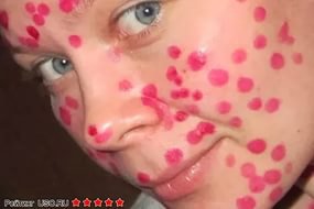 Зелёнка и фукорцин подоражали штоль?