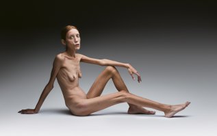 Кристинка красава.
Остальные ширококостные анорексички.