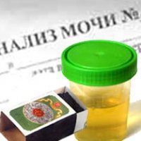 Это сейчас для сдачи анализов используют специальные баночки, а в моё детство кал в спичечном коробке носили.