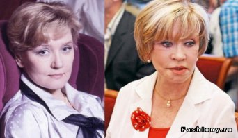 10 примеров неудачной пластики знаменитостей