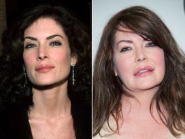 10 примеров неудачной пластики знаменитостей