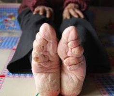 Ханьские девушки потрясли... С такими ножками - и в рванине, причем явно рабочей?! Вроде бы они не предназначены для работы-то. А если на "ножку" внимательно посмотреть - ужас. Счастье, что этого больше не делают!