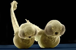 Их вид поражает и даже пугает. Микрочудища, живущие в морских глубинах