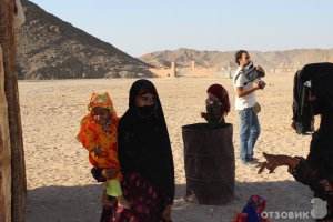 По статистике, альбиносы рождаются в 6 раз чаще у африканцев, чем у европейцев. На 3000 чернокожих младенцев приходится 1 альбинос. 
Большую концентрацию этой аномалии наблюдала в Египте, шоу такое-посещение поселений бедуинов,  с чаепитием и катанием на верблюдах. Там же много детей с синдромом Дауна.