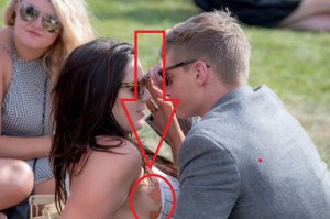 Что это??? Трудовые мазоли? Зачем столько пластырей??)))