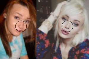 В списке забыли про ринопластику, которая явно была сделана.