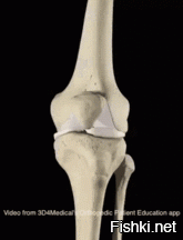 Так хирургически решается проблема с постоянными болями в коленном суставе