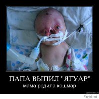 рожать имбецилов идиотов даунов сейчас модно, можно пропиариться на весь инет.