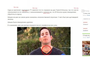 Просматривая любимую передачу, она заметила бугорок на шее ведущего