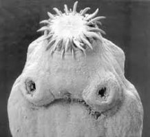 Бычий цепень - это бледно-желтый червь по меркам паразитарного мира не такой уж крупный — всего-то 12 метров (длина отдельных особей бычьего цепня может достигать 25 метров), но стоит представить такое «сокровище» внутри себя, как отчего-то становится очень-очень тошно. Данный бычий цепень был извлечен из тела иркутянина, и, надо отметить, он доставлял своему хозяину массу неудобств. Постоянная тошнота, рвота, схваткообразные боли в животе, недомогание, слабость — комфортно ли жить с такими симптомами?
Источник: СМ Номер один, № 25 от 2 июля 2009 года