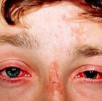 Ну зачем забавные фотографии комментировать? Смешнее они точно не становятся. Больно читать...