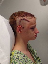 это не тату, а последствия операции височной доли мозга. на черепе не зашивают, скрепляют скобами и смотрится жутковато.