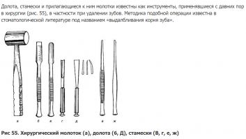 Вы не поверите, как часто в хирургической стоматологии приходится пользоваться этими инструментами