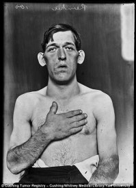 Опаньки... Сравниваем: на фото справа - актёр Стивен Фрай.