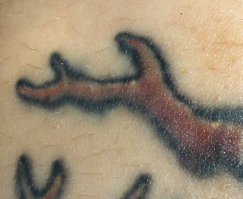 Имеется ввиду вот такой эффект. С годами это начинается всегда, поэтому тату не терпит мелких деталей.