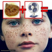 Уникальная красота людей с веснушками в портретах Брока Элбанка