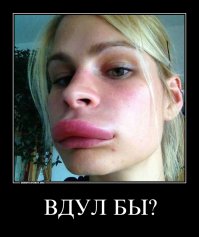 Кому пластика на пользу: фото знаменитостей до и после операций