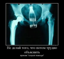 10 самых шокирующих рентген-снимков