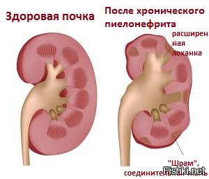 Порноактриса из «Игры престолов» обнажилась, протестуя против отправки российских обезьян на Марс