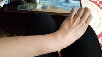 Что вы, автор, всё скайпом пугаете? Вот моя "культяпка", точно такая же, как вы нам демонстрируете, а у меня абсолютно здоровая рука, фото только что сделано, как говорится, найди семь отличий. Так что не надо. Уже достаточно людей, умеющих пользоваться интернетом, подняли и продемонстрировали кучу фактов в пользу того, что вы можете оказаться интернет-мошенником. Я этого не утверждаю, но моё фото, имхо, это тоже косвенно доказывает.