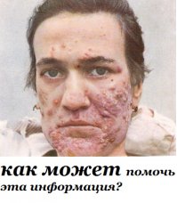 8 причин высыпаний на разных участках лица